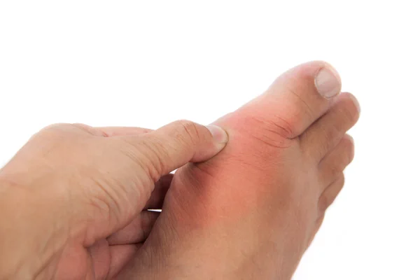 Gout infographic, GPAtlas Scope
